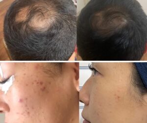 Re:DIVINE 肌再生と育毛メソッド